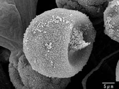 図5　図4左上のスギ花粉の拡大